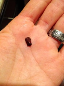 Looks like this tooth could belong to a 70-year-old Marlboro smoker...Nastiness, anyone?